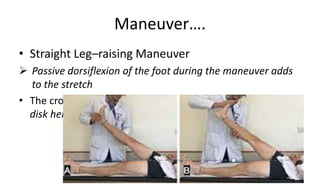 Maneuver….
• Straight Leg–raising Maneuver
 Passive dorsiflexion of the foot during the maneuver adds
to the stretch
• The crossed SLR sign is less sensitive but more specific for
disk herniation than the SLR sign
 