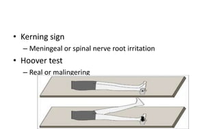 • Kerning sign
– Meningeal or spinal nerve root irritation
• Hoover test
– Real or malingering
 