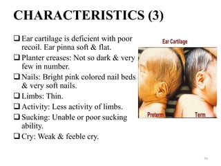 CHARACTERISTICS (3)
Ear cartilage is deficient with poor
recoil. Ear pinna soft & flat.
Planter creases: Not so dark & very
few in number.
Nails: Bright pink colored nail beds
& very soft nails.
Limbs: Thin.
Activity: Less activity of limbs.
Sucking: Unable or poor sucking
ability.
Cry: Weak & feeble cry.
50
 