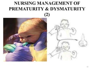 NURSING MANAGEMENT OF
PREMATURITY & DYSMATURITY
(2)
• Air passage should be cleared off mucus
promptly & gently using a mucus sucker.
• Adequate oxygenation through mask or nasal
catheter
• The baby should be wrapped in sterile towel &
is laid on one side in the cot with the head
slightly lowered.
85
 