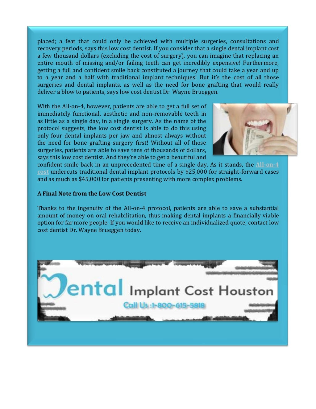 Low Cost Dentist Comparing the All on 4 to Traditional Dental Implant