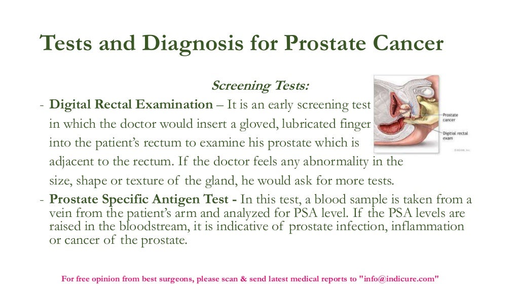 Low cost prostate cancer treatment in India