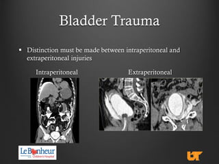 Lower urinary-tract-trauma-in-the-setting-of-pelvic-fractures | PDF
