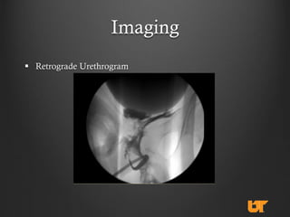 Lower urinary-tract-trauma-in-the-setting-of-pelvic-fractures | PDF