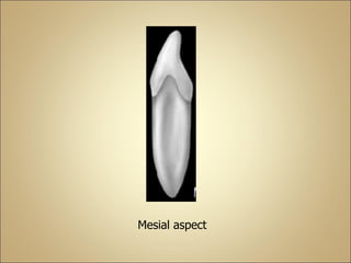 Mesial aspect
 