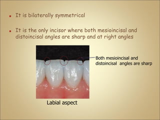 ■ It is bilaterally symmetrical
■ It is the only incisor where both mesioincisal and
distoincisal angles are sharp and at right angles
Labial aspect
Both mesioincisal and
distoincisal angles are sharp
 