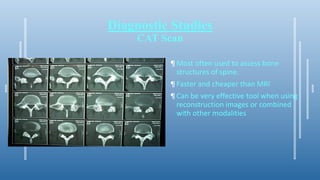 Diagnostic Studies
CAT Scan
¶ Most often used to assess bone
structures of spine.
¶ Faster and cheaper than MRI
¶ Can be very effective tool when using
reconstruction images or combined
with other modalities
 