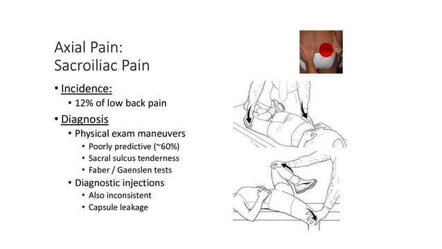 HOW DO DOCTORS TEST FOR BACK PAIN visual data 6