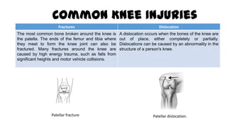 Common Knee Injuries
Fractures Dislocation
The most common bone broken around the knee is
the patella. The ends of the femur and tibia where
they meet to form the knee joint can also be
fractured. Many fractures around the knee are
caused by high energy trauma, such as falls from
significant heights and motor vehicle collisions.
A dislocation occurs when the bones of the knee are
out of place, either completely or partially.
Dislocations can be caused by an abnormality in the
structure of a person's knee.
Patellar fracture Patellar dislocation.
 
