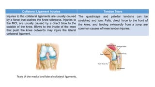 Collateral Ligament Injuries Tendon Tears
Injuries to the collateral ligaments are usually caused
by a force that pushes the knee sideways. Injuries to
the MCL are usually caused by a direct blow to the
outside of the knee. Blows to the inside of the knee
that push the knee outwards may injure the lateral
collateral ligament.
The quadriceps and patellar tendons can be
stretched and torn. Falls, direct force to the front of
the knee, and landing awkwardly from a jump are
common causes of knee tendon injuries.
Tears of the medial and lateral collateral ligaments.
 