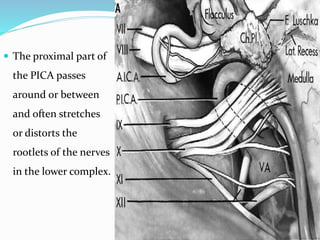 Pica Loop Lower cranial nerves ajay | PPTX