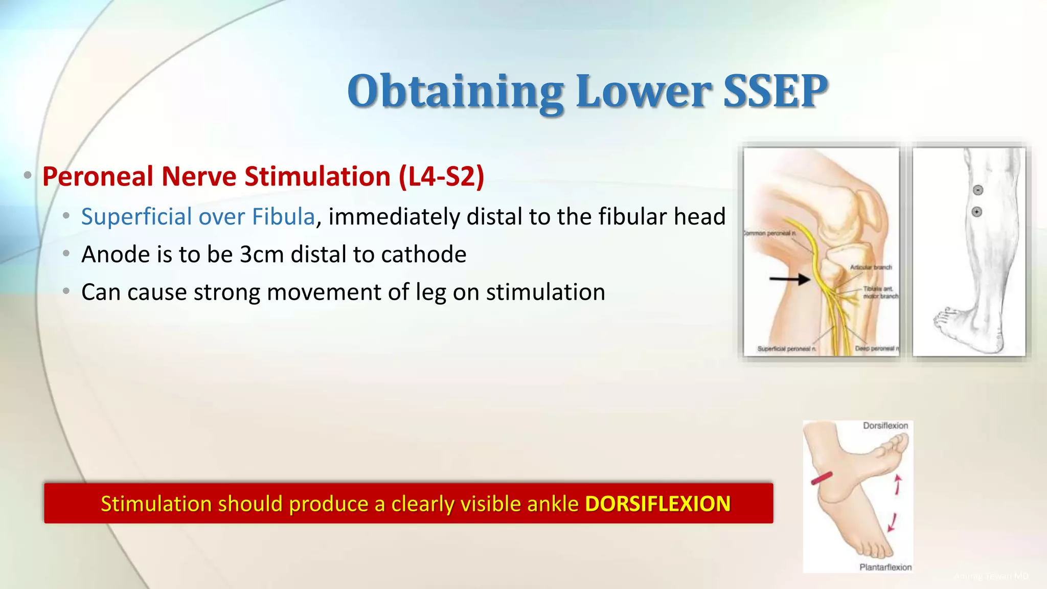 Lower Extremity Somatosensory Evoked Potentials (lower SSEP) | PPTX