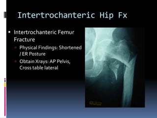 Intertrochanteric Hip Fx
 Intertrochanteric Femur
Fracture
 Physical Findings: Shortened
/ ER Posture
 Obtain Xrays: AP Pelvis,
Cross table lateral
 