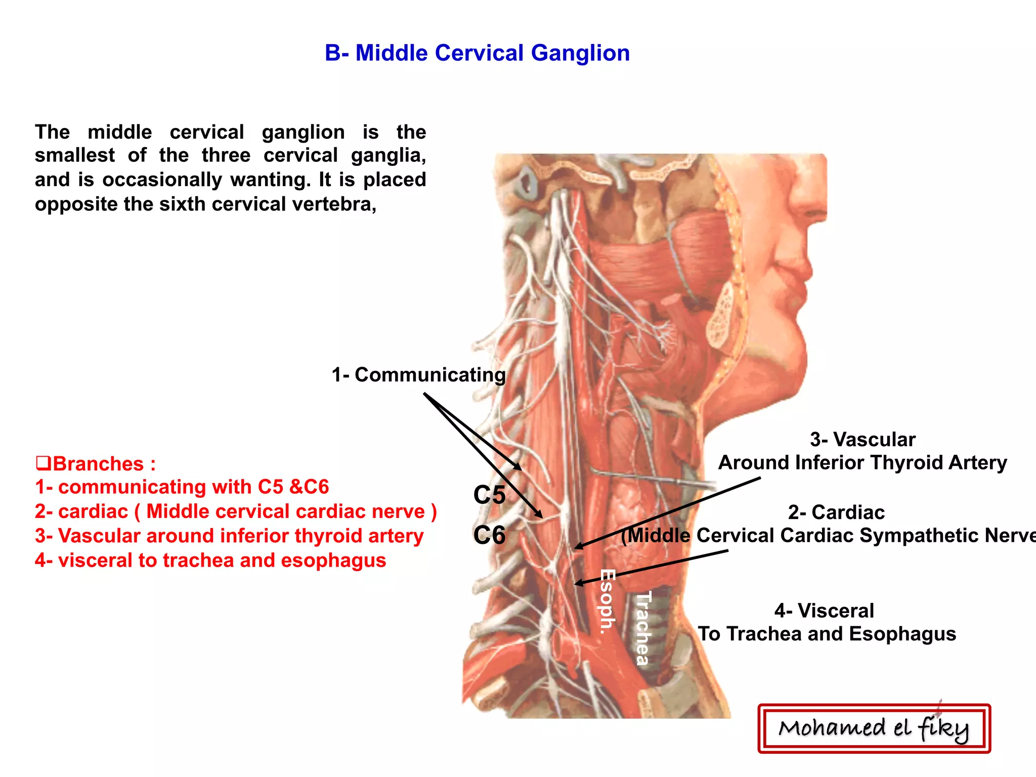 C5
C6
1- Communicating
2- Cardiac
(Middle Cervical Cardiac Sympathetic Nerve
3- Vascular
Around Inferior Thyroid Artery
4- Visceral
To Trachea and EsophagusTrachea
Esoph.
B- Middle Cervical Ganglion
The middle cervical ganglion is the
smallest of the three cervical ganglia,
and is occasionally wanting. It is placed
opposite the sixth cervical vertebra,
qBranches :
1- communicating with C5 &C6
2- cardiac ( Middle cervical cardiac nerve )
3- Vascular around inferior thyroid artery
4- visceral to trachea and esophagus
Mohamed el fiky
 