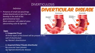 DIVERTICULOSIS
Definition
• Presence of small out-pouchings
(called diverticula) or sacs that can
develop in the wall of the
gastrointestinal tract.
Most common: Left sided of colon
(descending colon & sigmoid)
Types
1. Congenital (True)
All three layers of the bowel will be present in the
wall of diverticulum
eg: Meckel's diverticulum
2. Acquired (False/ Pseudo-diverticula)
No muscular layer present
eg: Sigmoid diverticular disease
 