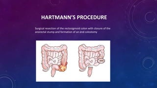 HARTMANN’S PROCEDURE
Surgical resection of the rectosigmoid colon with closure of the
anorectal stump and formation of an end colostomy
 
