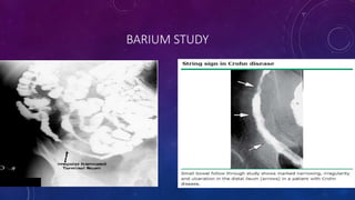BARIUM STUDY
 