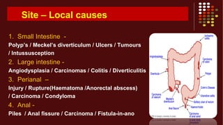 Site – Local causes
1. Small Intestine -
Polyp’s / Meckel’s diverticulum / Ulcers / Tumours
/ Intussusception
2. Large intestine -
Angiodysplasia / Carcinomas / Colitis / Diverticulitis
3. Perianal –
Injury / Rupture(Haematoma /Anorectal abscess)
/ Carcinoma / Condyloma
4. Anal -
Piles / Anal fissure / Carcinoma / Fistula-in-ano
 