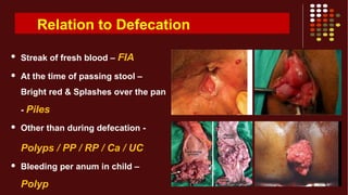 Relation to Defecation
 Streak of fresh blood – FIA
 At the time of passing stool –
Bright red & Splashes over the pan
- Piles
 Other than during defecation -
Polyps / PP / RP / Ca / UC
 Bleeding per anum in child –
Polyp
 