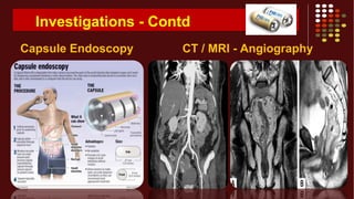 Investigations - Contd
Capsule Endoscopy CT / MRI - Angiography
 