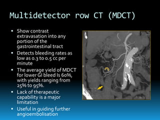 Multidetector row CT (MDCT)
 Show contrast
extravasation into any
portion of the
gastrointestinal tract
 Detects bleeding rates as
low as 0.3 to 0.5 cc per
minute
 The average yield of MDCT
for lower GI bleed Is 60%,
with yields ranging from
25% to 95%.
 Lack of therapeutic
capability is a major
limitation
 Useful in guiding further
angioembolisation
 