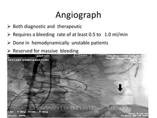 Angiograph
 Both diagnostic and therapeutic
 Requires a bleeding rate of at least 0.5 to 1.0 ml/min
 Done in hemodynamically unstable patients
 Reserved for massive bleeding
 