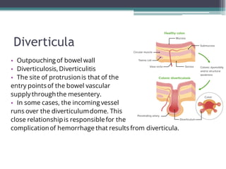 Lower GI bleed.pdf
