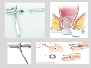 Lower gi bleeding | PPTX