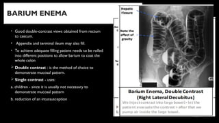 Comprehensive Anatomy and Embryology of the Lower Gastrointestinal ...