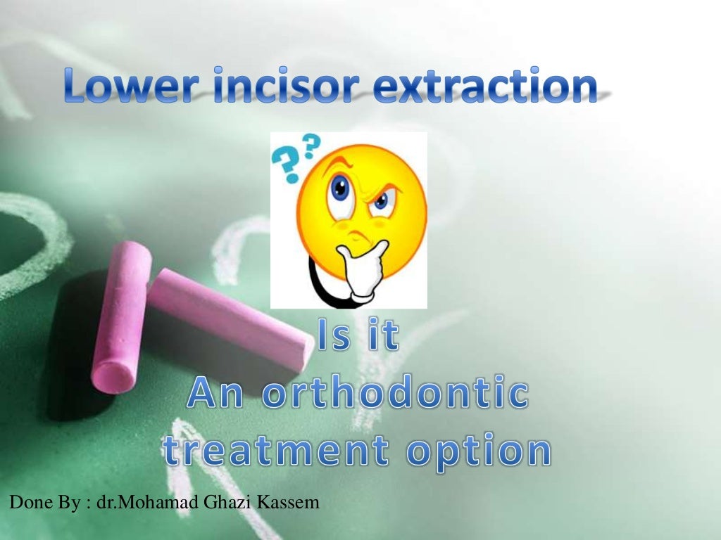 Lower incisor extraction in Orthodontics
