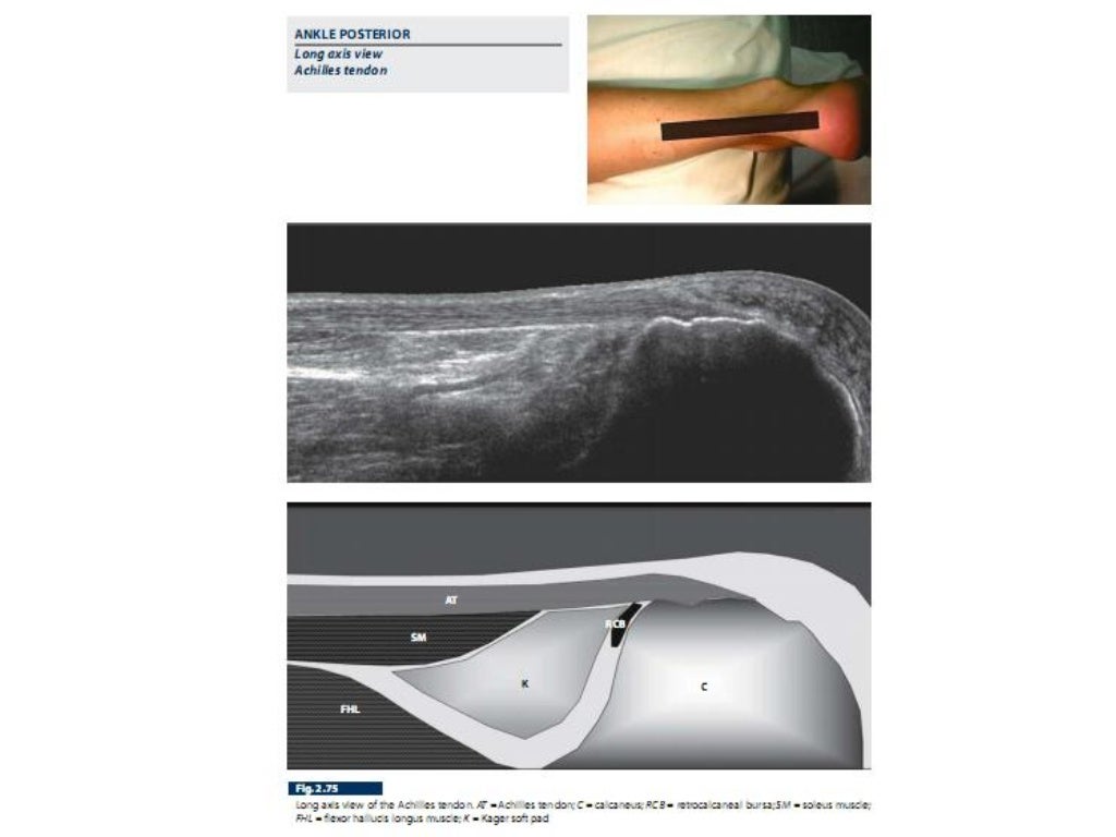 US Anatomy _ Lower Limb
