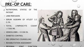 PRE-OP CARE:
• NUTRITIONAL STATUS OF THE
PATIENT
• LIMB PERFUSION
• SERUM ALBUMIN OF ATLEST 3.5
G/DL
• TOTAL LYMPHOCYTE COUNT
>1500/ML
• HEMOGLOBIN >10 GM/DL
• DIABETES CONTROL
• PRE OPERATIVE COUNSELLING
• REHABILITATION ASSESSMENT
 