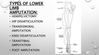 TYPES OF LOWER
LIMB
AMPUTATION:
• HEMIPELVICTOMY
• HIP DISARTICULATION
• TRANSFEMORAL
AMPUTATION
• KNEE DISARTICULATION
• TRANSTIBIAL
AMPUTATION
• FOOT AMPUTATION
 