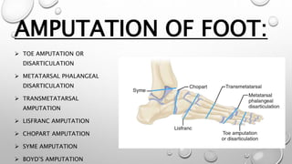 AMPUTATION OF FOOT:
 TOE AMPUTATION OR
DISARTICULATION
 METATARSAL PHALANGEAL
DISARTICULATION
 TRANSMETATARSAL
AMPUTATION
 LISFRANC AMPUTATION
 CHOPART AMPUTATION
 SYME AMPUTATION
 BOYD’S AMPUTATION
 
