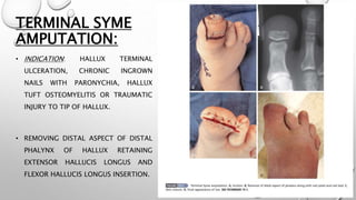 TERMINAL SYME
AMPUTATION:
• INDICATION: HALLUX TERMINAL
ULCERATION, CHRONIC INGROWN
NAILS WITH PARONYCHIA, HALLUX
TUFT OSTEOMYELITIS OR TRAUMATIC
INJURY TO TIP OF HALLUX.
• REMOVING DISTAL ASPECT OF DISTAL
PHALYNX OF HALLUX RETAINING
EXTENSOR HALLUCIS LONGUS AND
FLEXOR HALLUCIS LONGUS INSERTION.
 