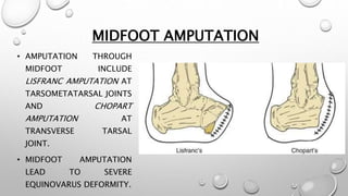 MIDFOOT AMPUTATION
• AMPUTATION THROUGH
MIDFOOT INCLUDE
LISFRANC AMPUTATION AT
TARSOMETATARSAL JOINTS
AND CHOPART
AMPUTATION AT
TRANSVERSE TARSAL
JOINT.
• MIDFOOT AMPUTATION
LEAD TO SEVERE
EQUINOVARUS DEFORMITY.
 