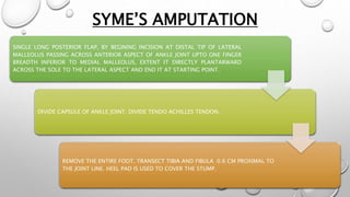 SYME’S AMPUTATION
SINGLE LONG POSTERIOR FLAP, BY BEGINING INCISION AT DISTAL TIP OF LATERAL
MALLEOLUS PASSING ACROSS ANTERIOR ASPECT OF ANKLE JOINT UPTO ONE FINGER
BREADTH INFERIOR TO MEDIAL MALLEOLUS, EXTENT IT DIRECTLY PLANTARWARD
ACROSS THE SOLE TO THE LATERAL ASPECT AND END IT AT STARTING POINT.
DIVIDE CAPSULE OF ANKLE JOINT. DIVIDE TENDO ACHILLES TENDON.
REMOVE THE ENTIRE FOOT. TRANSECT TIBIA AND FIBULA 0.6 CM PROXIMAL TO
THE JOINT LINE. HEEL PAD IS USED TO COVER THE STUMP.
 