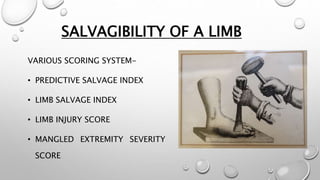 SALVAGIBILITY OF A LIMB
VARIOUS SCORING SYSTEM-
• PREDICTIVE SALVAGE INDEX
• LIMB SALVAGE INDEX
• LIMB INJURY SCORE
• MANGLED EXTREMITY SEVERITY
SCORE
 