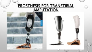 PROSTHESIS FOR TRANSTIBIAL
AMPUTATION
 