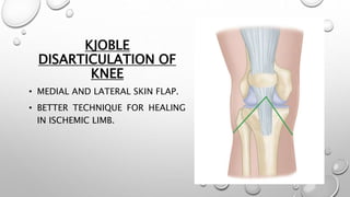 KJOBLE
DISARTICULATION OF
KNEE
• MEDIAL AND LATERAL SKIN FLAP.
• BETTER TECHNIQUE FOR HEALING
IN ISCHEMIC LIMB.
 