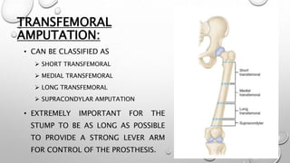 TRANSFEMORAL
AMPUTATION:
• CAN BE CLASSIFIED AS
 SHORT TRANSFEMORAL
 MEDIAL TRANSFEMORAL
 LONG TRANSFEMORAL
 SUPRACONDYLAR AMPUTATION
• EXTREMELY IMPORTANT FOR THE
STUMP TO BE AS LONG AS POSSIBLE
TO PROVIDE A STRONG LEVER ARM
FOR CONTROL OF THE PROSTHESIS.
 