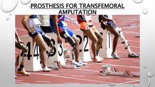 PROSTHESIS FOR TRANSFEMORAL
AMPUTATION
 