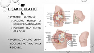 HIP
DISARTICULATIO
N
• DFFERENT TECHINUES-
 ANATOMIC METHOD OF
BOYD HIP DISARTICULATION.
 POSTERIOR FLAP METHOD
OF SLOCUM.
• INGUINAL OR ILIAC LYMPH
NODE ARE NOT ROUTINELY
REMOVED.
 