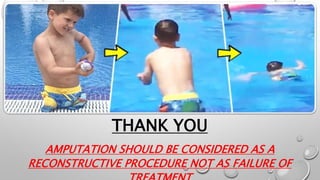 THANK YOU
AMPUTATION SHOULD BE CONSIDERED AS A
RECONSTRUCTIVE PROCEDURE NOT AS FAILURE OF
 