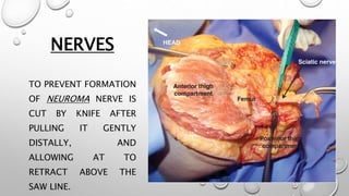 NERVES
TO PREVENT FORMATION
OF NEUROMA NERVE IS
CUT BY KNIFE AFTER
PULLING IT GENTLY
DISTALLY, AND
ALLOWING AT TO
RETRACT ABOVE THE
SAW LINE.
 