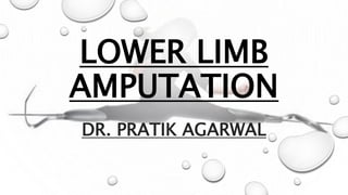LOWER LIMB
AMPUTATION
DR. PRATIK AGARWAL
 