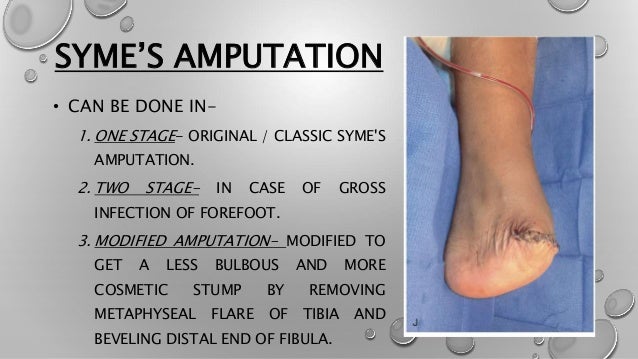 Lower limb amputation