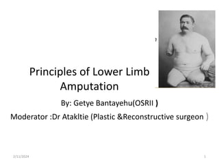 Principles of Lower Limb
Amputation
By: Getye Bantayehu(OSRII )
Moderator :Dr Atakltie (Plastic &Reconstructive surgeon )
2/11/2024 1
 
