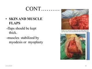 CONT…………..
• SKIN AND MUSCLE
FLAPS
-flaps should be kept
thick.
-muscles stabilized by
myodesis or myoplasty
2/11/2024 18
 