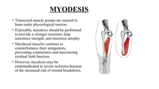 LOWER LIMB AMPUTATION SO much for [1].pptx